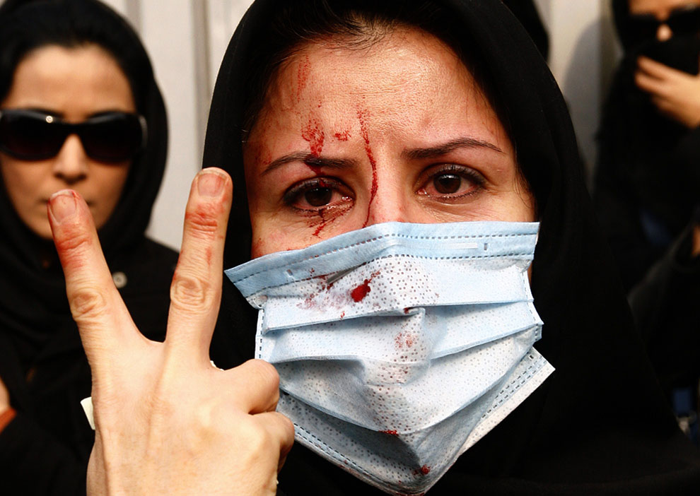 An injured Iranian opposition supporter flashes a V-sign during clashes with security forces in Tehran on December 27, 2009.