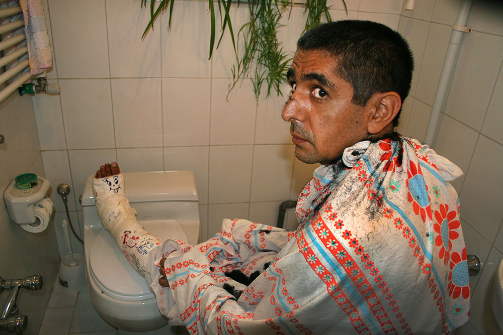 2. Jassem à 42 ans, dans les toilettes, avec une jambe coupée par une scie ; il est photographié en train d'attendre que Vida lui coupe les cheveux.